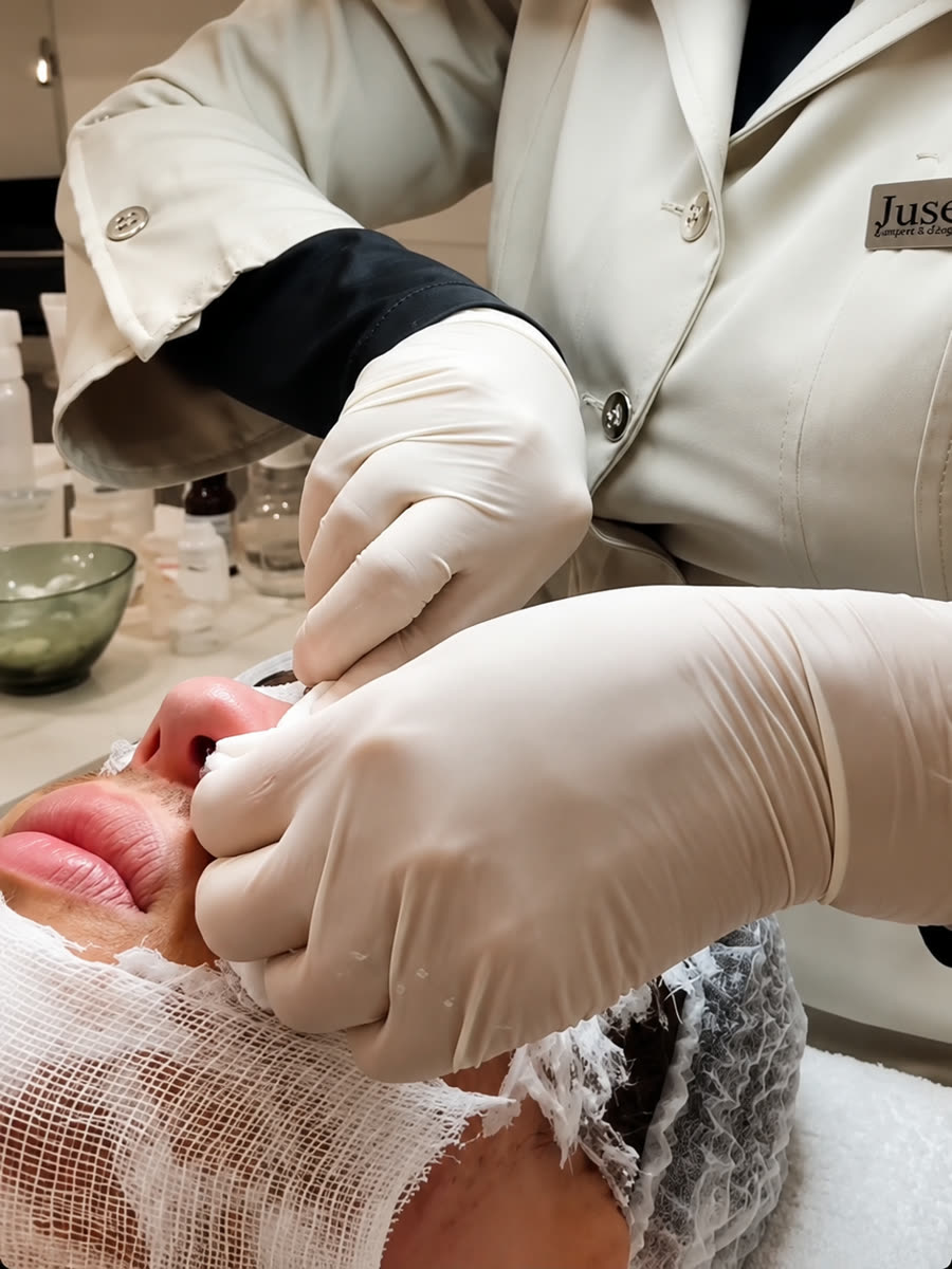 Procedimento de estética no Ampliato Salão Center